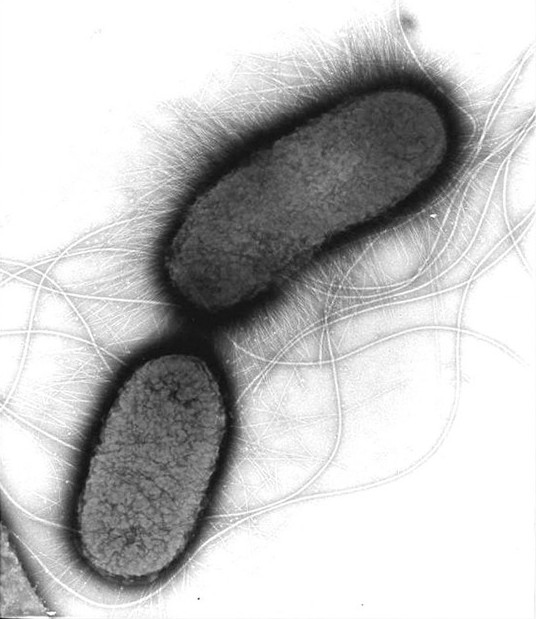 图2:大肠杆菌电镜图肠道菌群该如何保护?